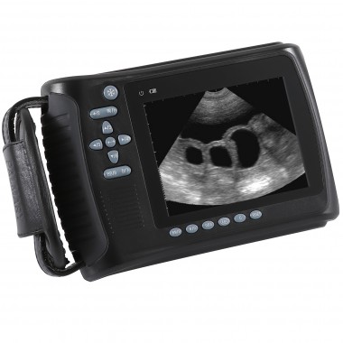 Ultrasound Scanner