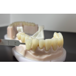 CE/FDA Certified Crowns & Bridges