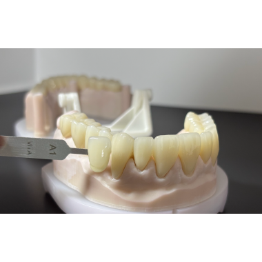 CE/FDA Certified Crowns & Bridges