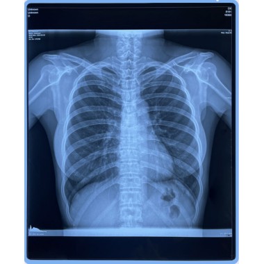 Porcelain white inkjet film