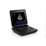 Color Doppler Diagnostic Ultrasound System