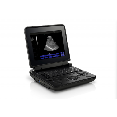Color Doppler Diagnostic Ultrasound System