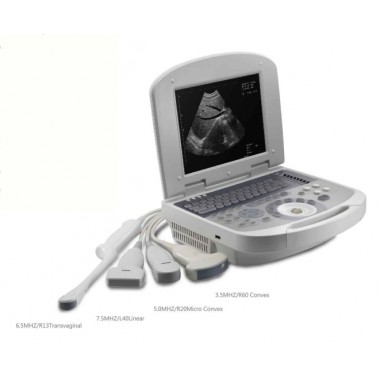 Laptop Ultrasound Machine