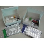 ELISA Kit for HBV Pre-S Antigen  (Two-step Double Antibody Sandwich immunoassay)