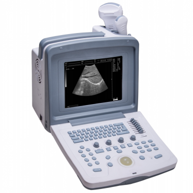 Full Digital Ultrasonic Diagnostic System