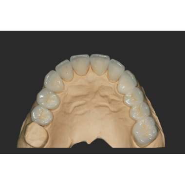 Fixed Removable Dental Laboratory Services