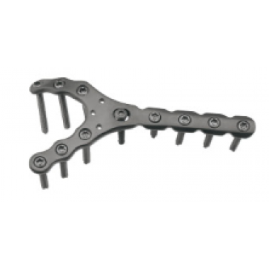 3.5mm Olecranon Fossa Locking Plates
