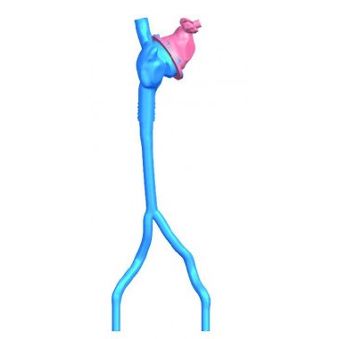 Left Atrial Appendage Vessel Model