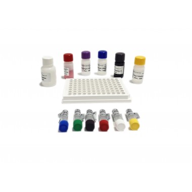Human SORT1(Sortilin) ELISA Kit