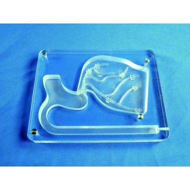 Planar Left Coronary Vessel Model  (Radial Artery Approach)