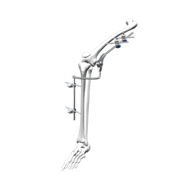 Knee Joint