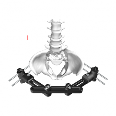 Pelvic Fixator