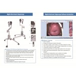 China digital video colposcope manufacturers