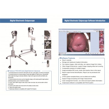 China digital video colposcope manufacturers