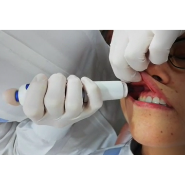 Neddleless syringe for anesthetics