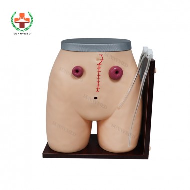 SY-N059 Nursing Training Model Ostomy Nursing Model