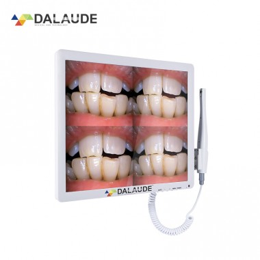 Intra Oral Camera