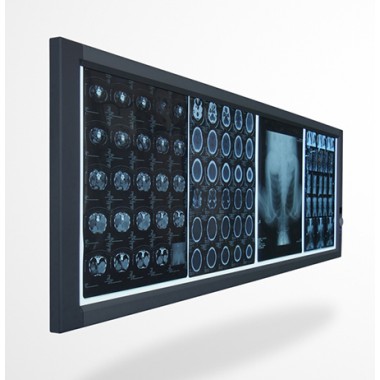 X-Ray film Viewer