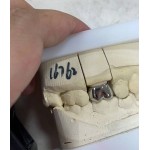 Seattle Dental Laborator