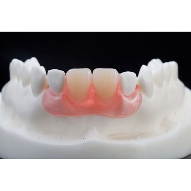 Dental lab in Shenzhen|Dental lab in China|Denture manufacturer