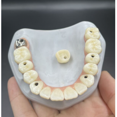 China dental screwed denture manufacturers, suppliers, factory
