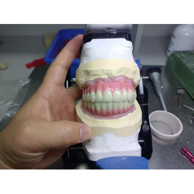 Myy Dental Lab Zirconia Dental Implants Dental Lab