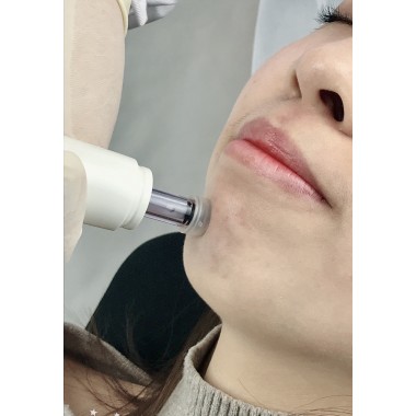 Dermo Beauty Pen
