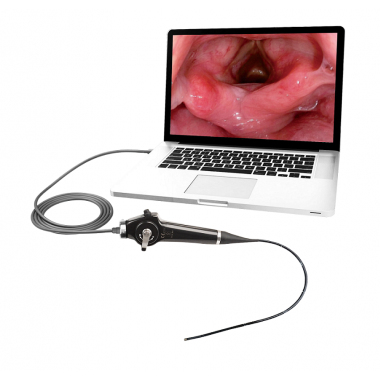 1 million pixel USB flexible video rhinolaryngoscope connect with PC directly