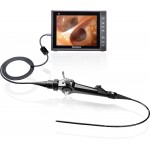 Seesheen flexible choledochoscope video endoscope