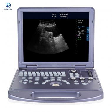 Portable Digital black ultrasound Scanner ME360