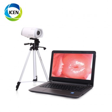 IN-G9800 Portable Gynecology Colposcopy Instruments Self-Exam Full Hd Beautiful Video Camera For Vagina Colposcope