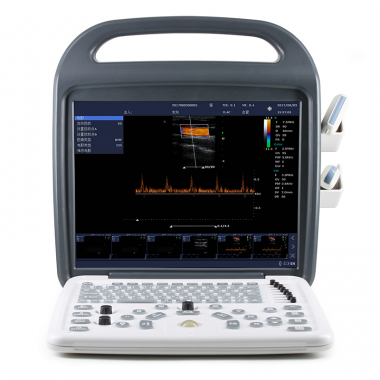 Color Portable Ultrasound