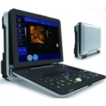 Laptop Ultrasound machine Color Doppler scanner machine 3D/ 4D model C300