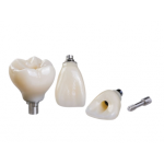 Chinese dental labs