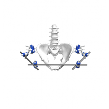 Pelvic Fixation