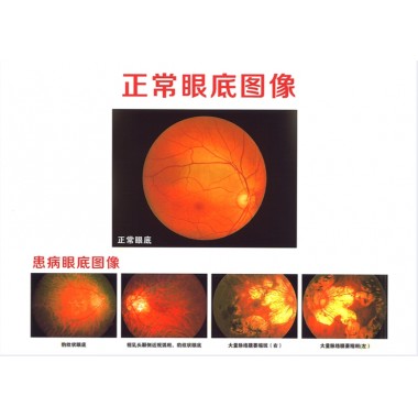 Porcelain white laser film