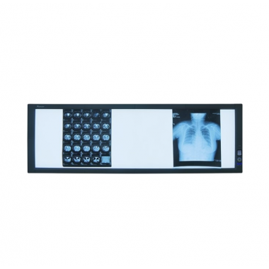 LCD/LED film viewer