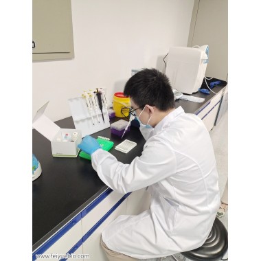 Human anti-2019 nCoV(S) IgG ELISA Kit
