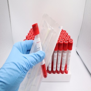 Disposable Factory Virus Transport Medium Vtm Sampling Collection Tube