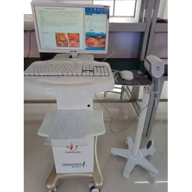 colposcope