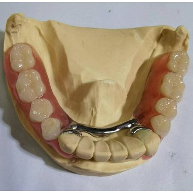 Valplast Partial Denture lab
