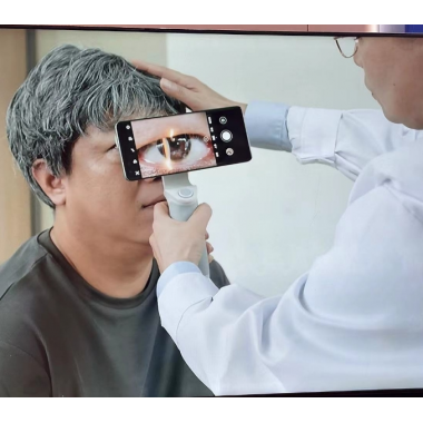 Hand slit lamp