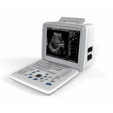 Portable B/W Ultrasound Scanner with Clear Image Quality