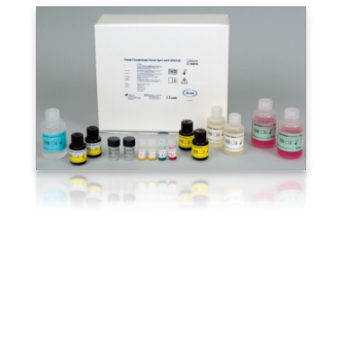 HIV Microelisa System