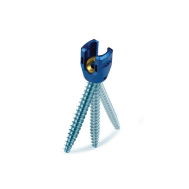 Pedicle Screws