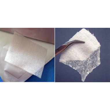 Soluble Gauze For Hemostasis