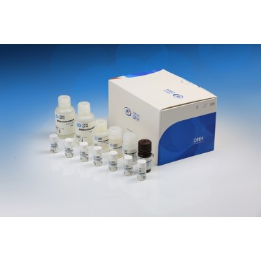 Dynamiker Aspergillus fumigatus IgM Assay