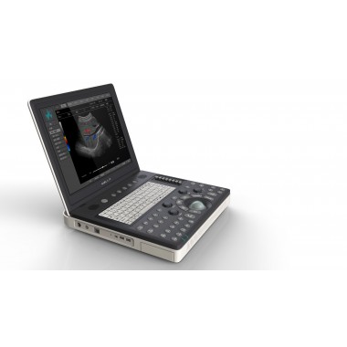 color doppler ultrasound scanner