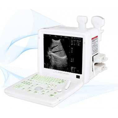 DW-360 Full-digital Portable Ultrasound Scanner