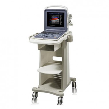 YJ-U60PLUS 4D Trolley Laptop Color Doppler Echo Doppler